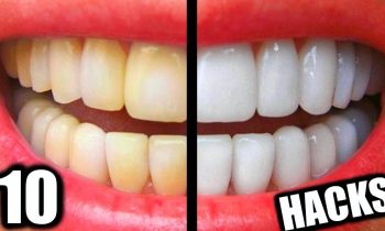 10 Simple Life Hacks For Teeth Whitening Everyone Should Know! DIY Teeth Whitening Hacks!