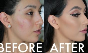 HOW TO COVER PIMPLES, UNDER EYE CIRCLES & BRUISES | BEAUTYYBIRD