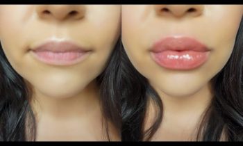 How-To-Get-BIG-HUGE-Lips-Without-Injections-Or-Overlining-ACTUALLY-WORKS-Candylipz
