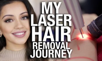 My Laser Hair Removal Journey