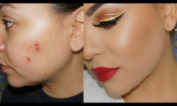 How to Cover Acne with Makeup ! Cystic Acne & Acne Scars !